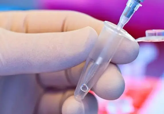 男精子活力低试管婴儿步骤